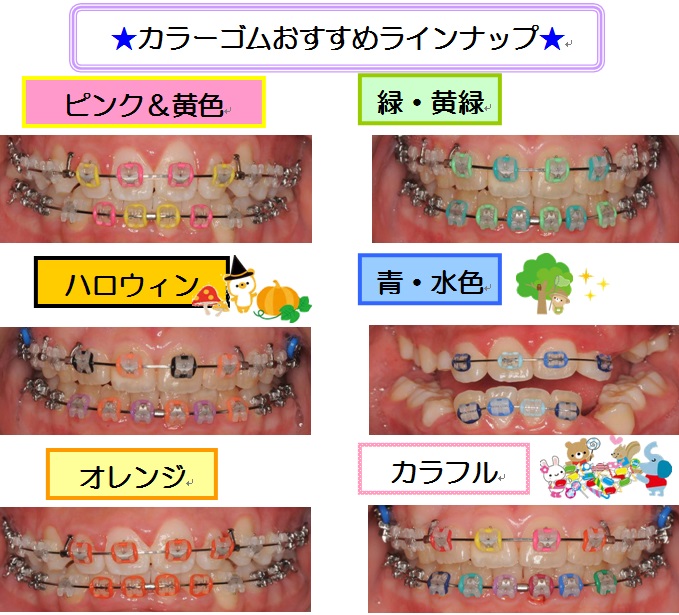 人生で一度はトライ！カラーゴム さいとう矯正歯科 横須賀市